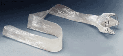 Image: The EndoBarrier Gastrointestinal Liner System (Photo courtesy GI Dynamics).